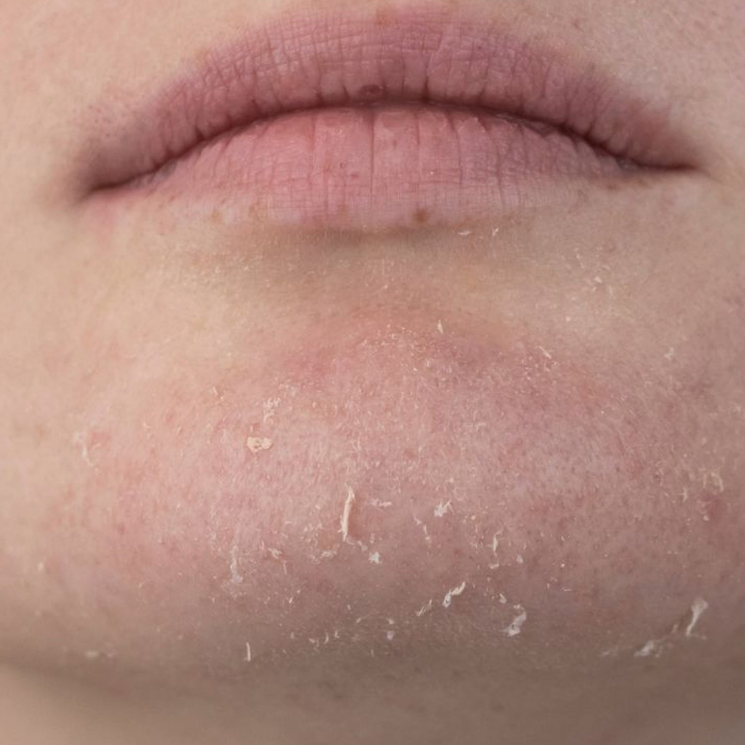 Peau Sèche - Avure Skincare