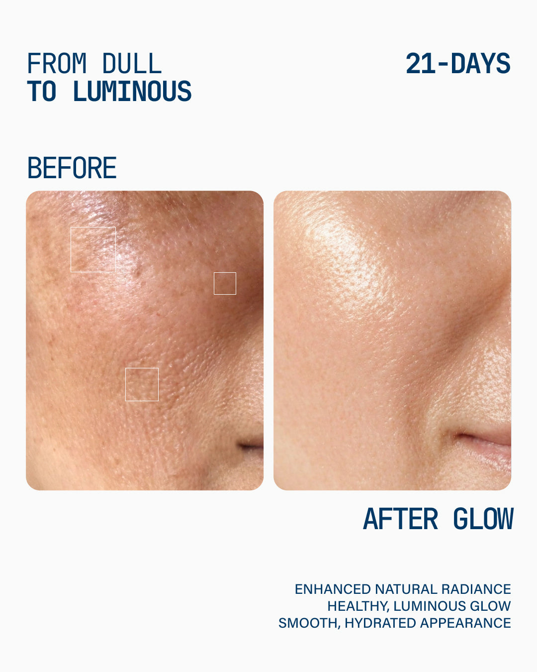 Glow concentrate serum - vitamine C15%